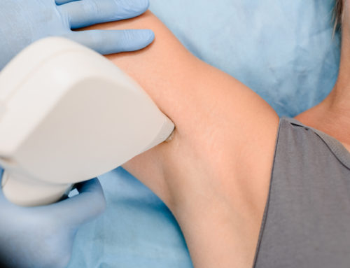 IPL permanent hair removal: All your questions answered