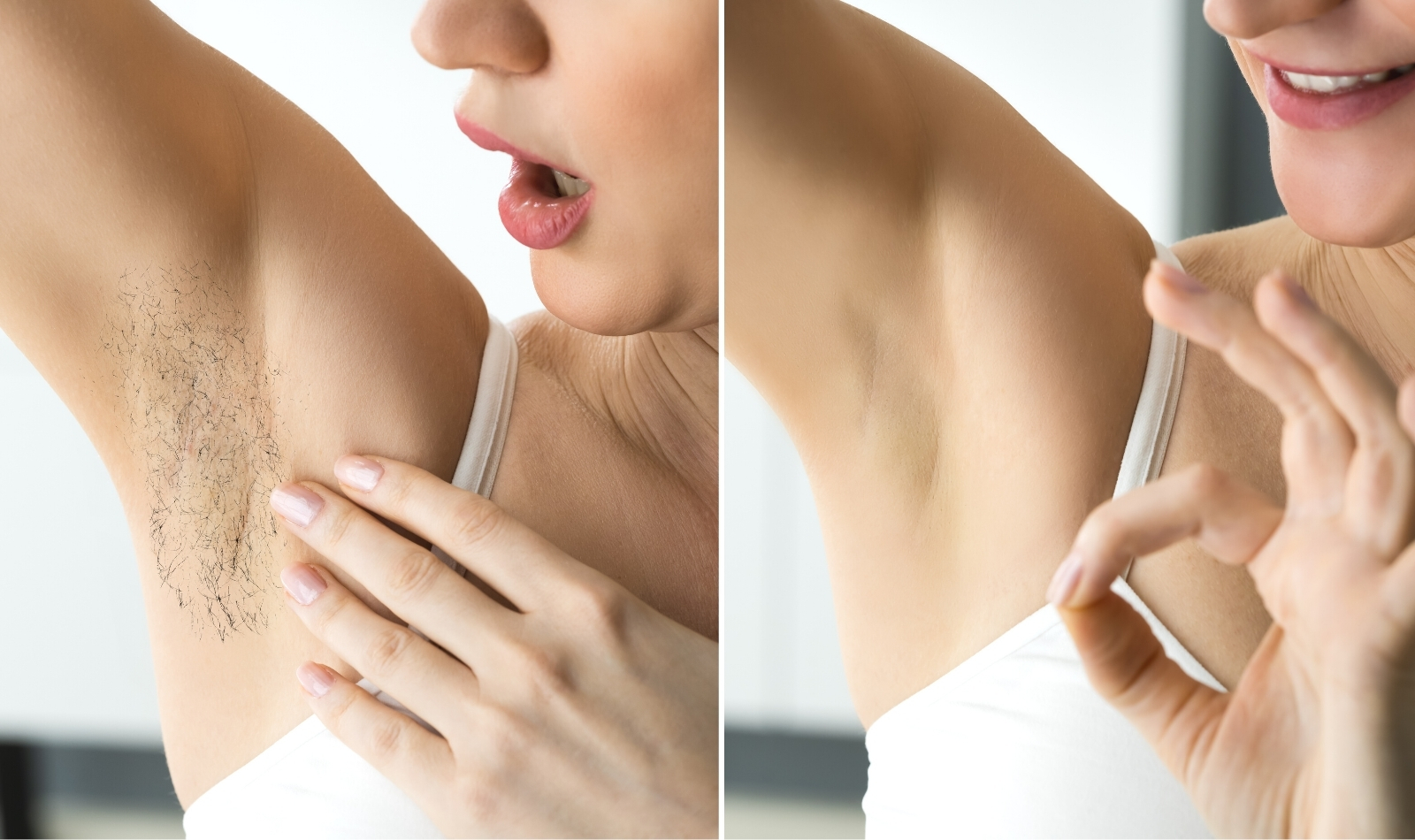 Is IPL hair removal permanent and safe?