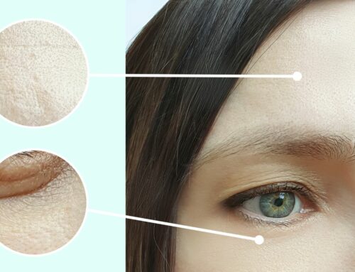 How to reduce wrinkles under eyes, on your forehead and around your mouth without fillers