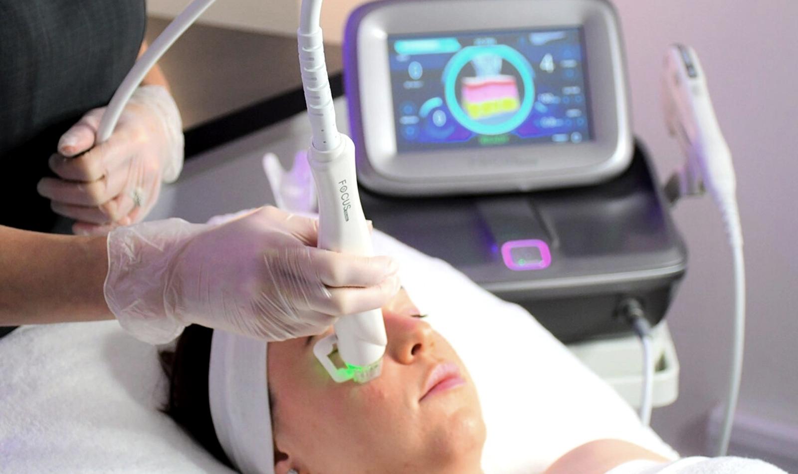 microneedling with radiofrequency