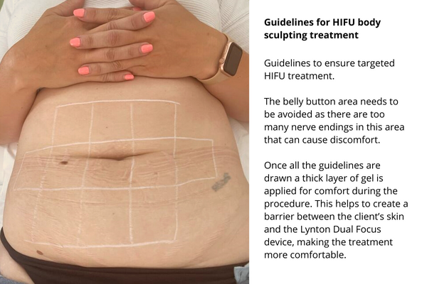 HIFU body sculpting guidelines