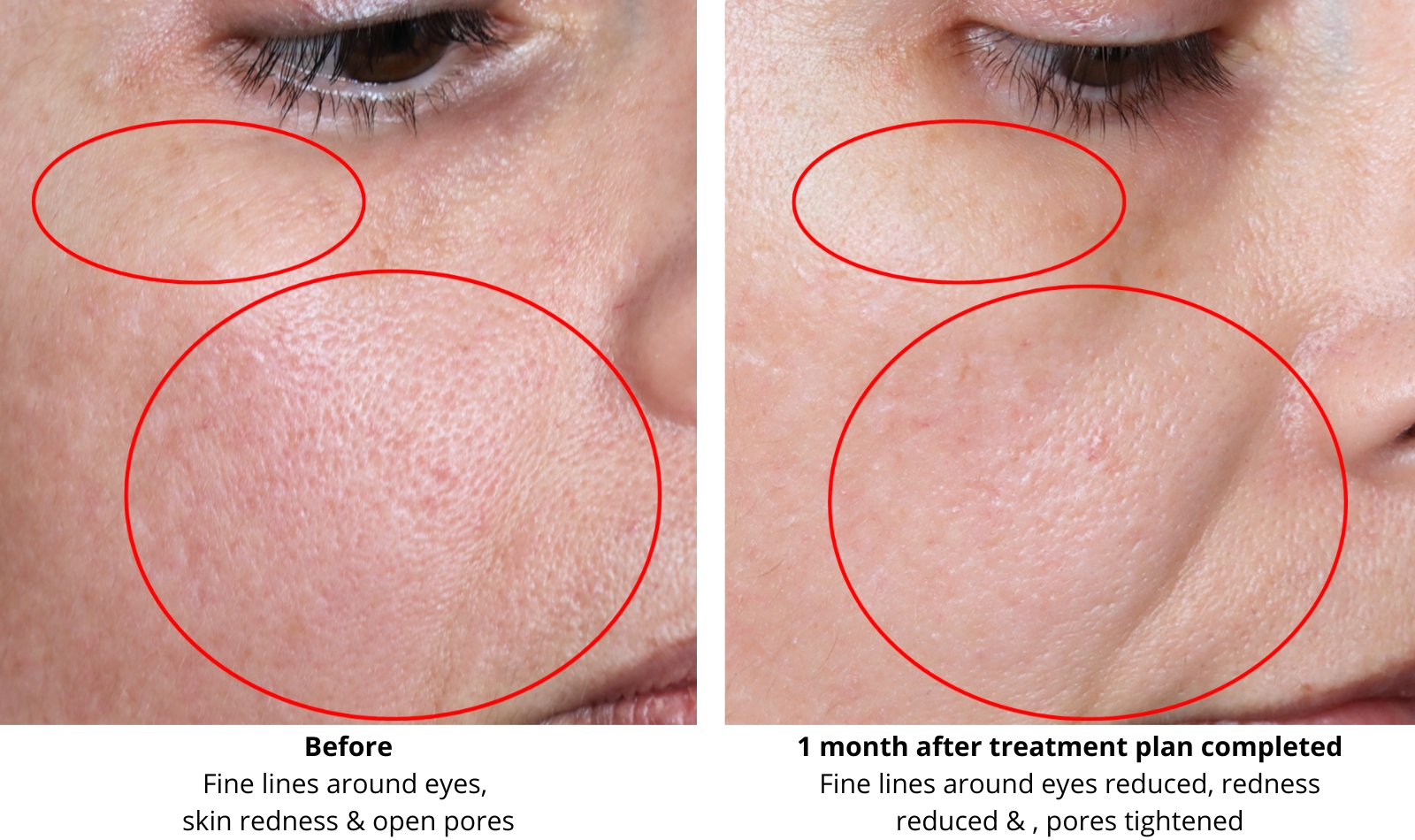 skin rejuvenation treatment Basingstoke Hampshire